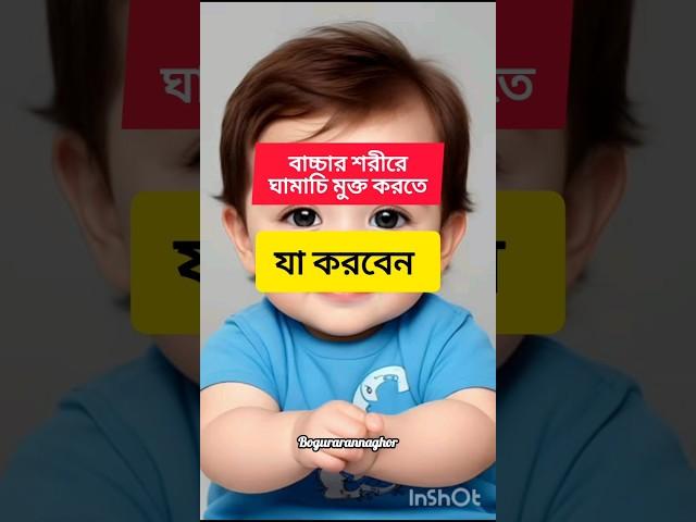 বাচ্চা শরীরে ঘামাচি মুক্ত করতে যা করবেন #parentingtips #baby #youtubeshorts