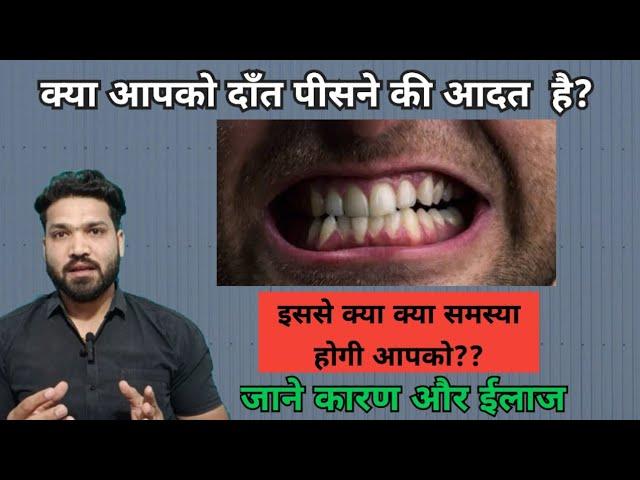 Bruxism, Problems, causes and treatment