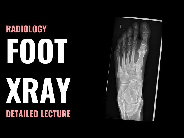 Foot Xray - Radiology - Detailed Lecture