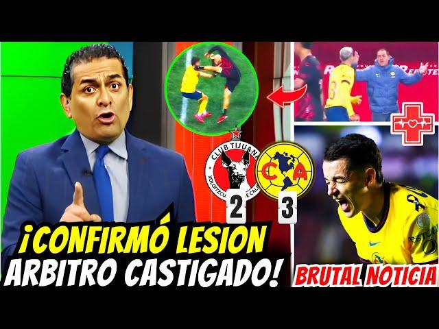 FMF CONFIRMA CASTIGO  AMÉRICA REMONTA 3-2 A PESAR DEL ROBO ARBITRAL | AMERICA vs TIJUANA