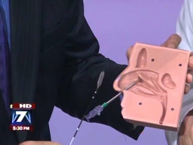 Balloon Sinuplasty | Dr. Daniel Leeman | Austin ENT