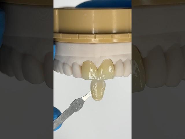 Terrific Central Incisors #lsk121shorts #dentist #teeth