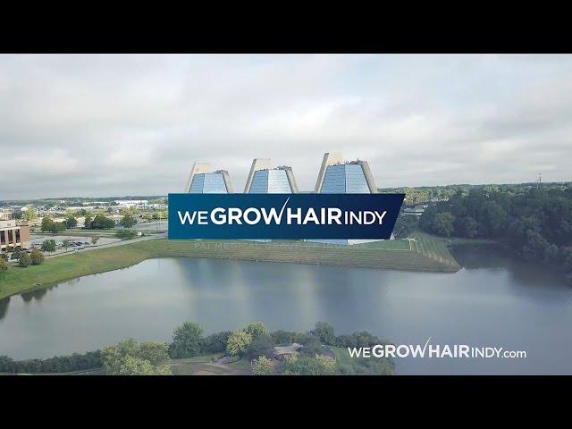 We Grow Hair Indy I Indianapolis Hair Restoration Specialists