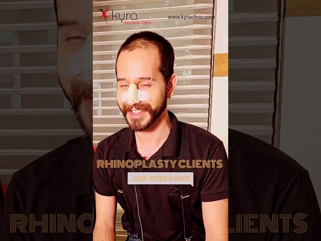 Rhinoplasty Review Ludhiana | Rhinoplasty Review Punjab | The Surgeon Behind Rhino Transformations