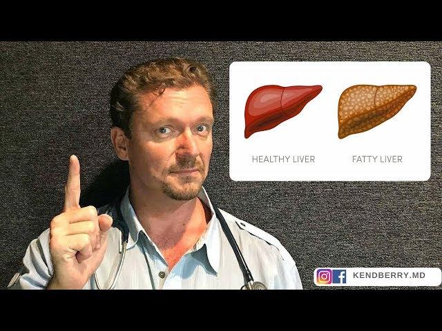  STOP These 5 Things to Reverse Fatty Liver (Update 2024) 