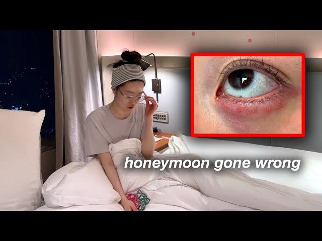 Got a Nasty Eye Infection during Romantic Honey Moon