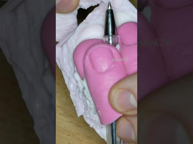 Finger in epoxy resin
