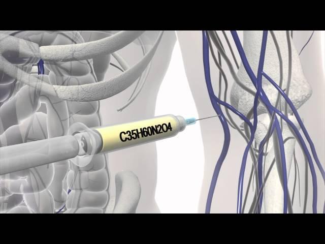 Lethal injection explained