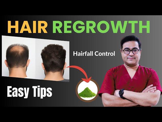 Guaranteed Hair Regrowth Tips by Dr. Vikram | #hairregrowth #hairfall