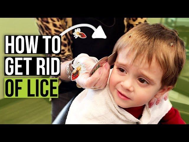 Head Lice Combing Techniques - How to Check for Lice at Home