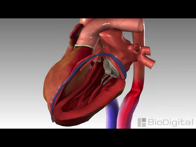 3D Medical Animation - Congestive Heart Failure