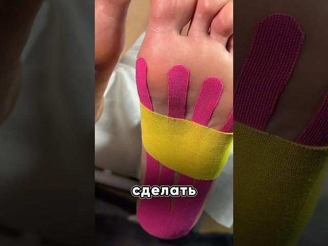 #тейп #тейпирование #плоскостопие