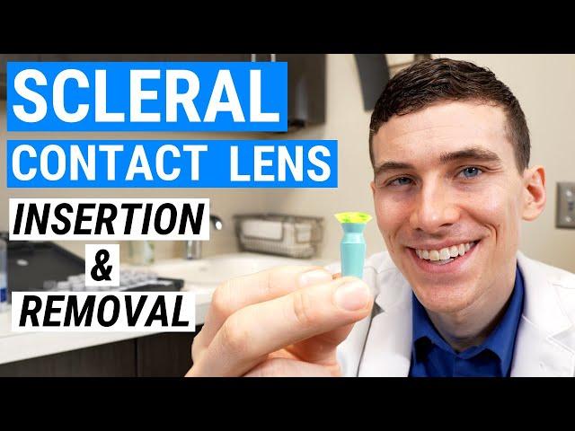 How to Insert and Remove SCLERAL LENSES | Beginners Guide to Scleral Lenses