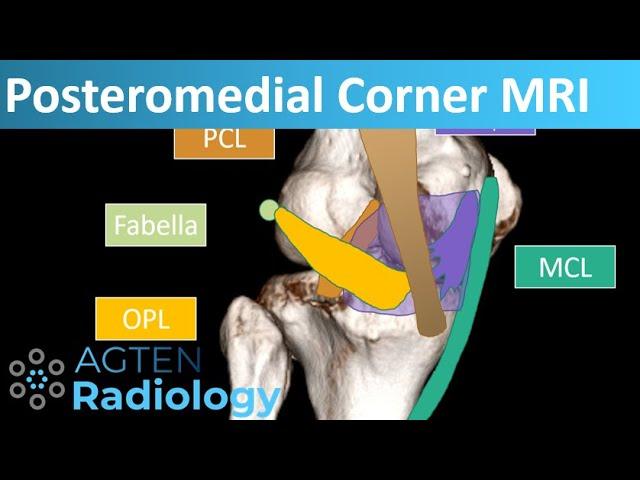 Posteromedial Corner Anatomy on Knee MRI