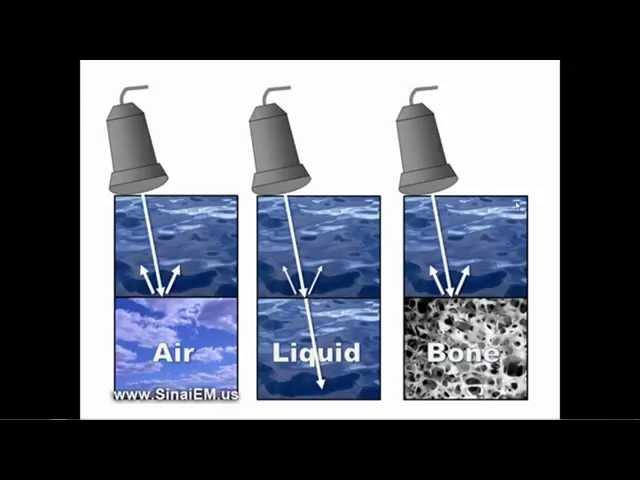 Ultrasound Basics