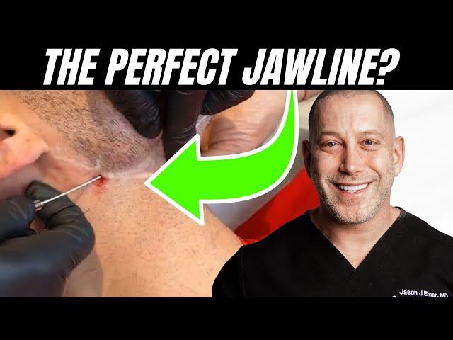 The Secret to a More Masculine, Defined Face! | Dr. Jason Emer