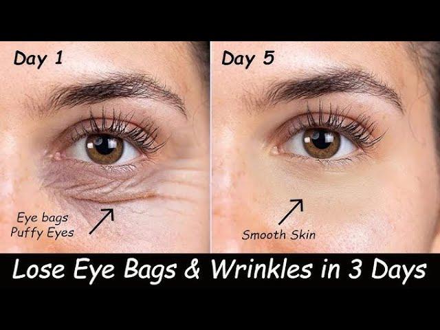 Remove Under Eye Wrinkles , Puffy Eyes & Dark Circles & Under eye cream  for dark circles &Wrinkle