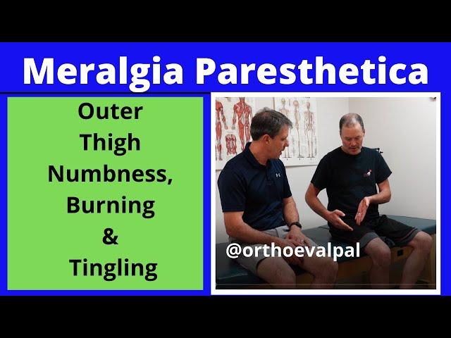 Meralgia Paresthetica (Outer thigh numbness, burning and tingling)