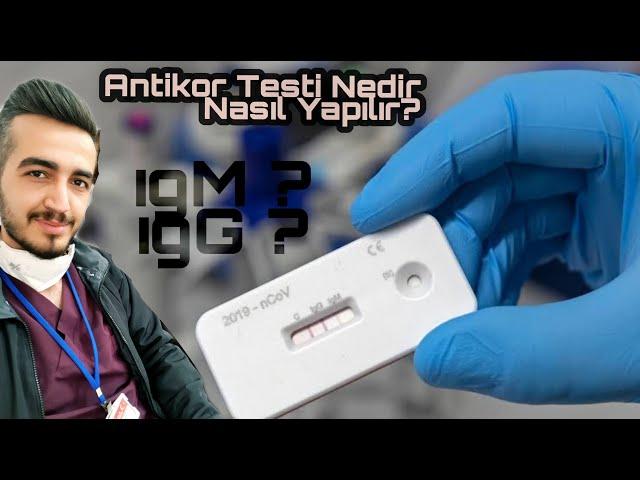 Antikor testi nedir nasıl yapılır ?