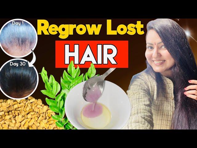 30 Days *Winter Hair Growth* Transformation : Fix Bald Patches Receding Hairline & Regrow Lost Hair