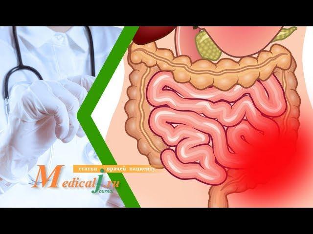 Острая кишечная непроходимость: причины, симптомы и лечение