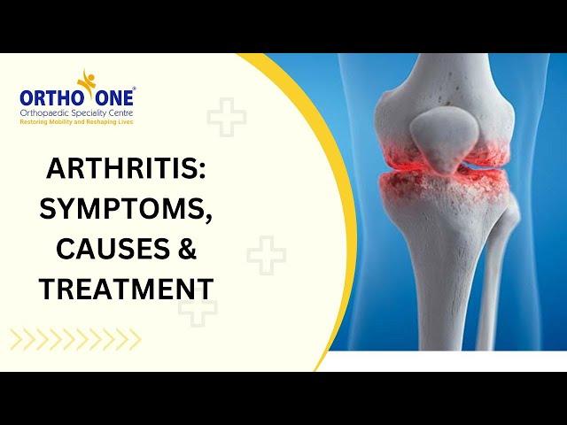 Arthritis: Symptoms, Causes & Treatment | Ortho-One | Coimbatore