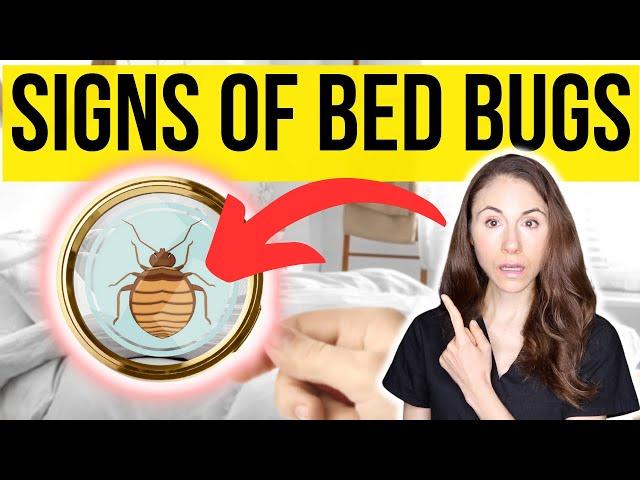 Signs You Have Bed Bugs And How To Get Rid Of Them