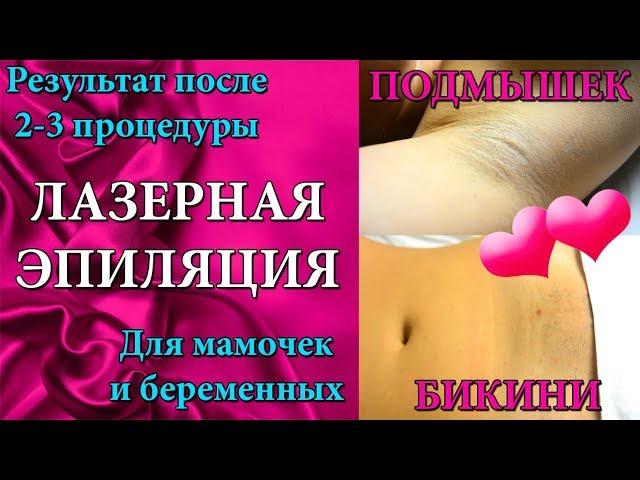 ЛАЗЕРНАЯ ЭПИЛЯЦИЯ БИКИНИ И ПОДМЫШЕК В СОЧИ ️ BEAUTY CLUB MAFIA SOCHI  ЛАЗЕР ДЛЯ МАМОЧЕК