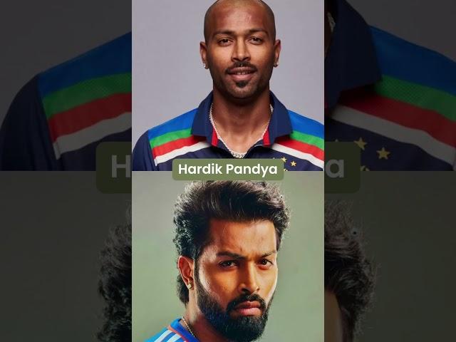 Cricketers who have undergone a Hair transplant | Elegance Clinic - Surat #hairtransplant #cricketer