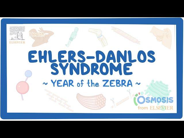 Ehlers-Danlos syndrome (Year of the Zebra)