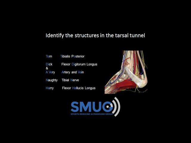 Medial ankle. Identify structures in the tarsal tunnel