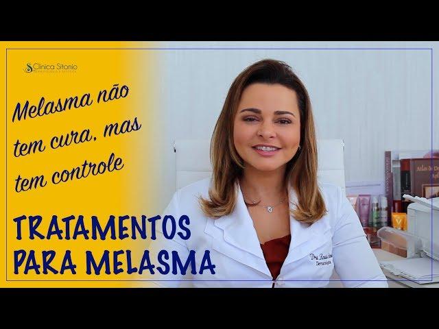 Tratamentos para melasma - Dra Renata Sitonio.