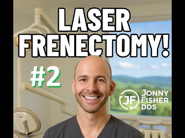 Laser Frenectomy! (Lower Lip)