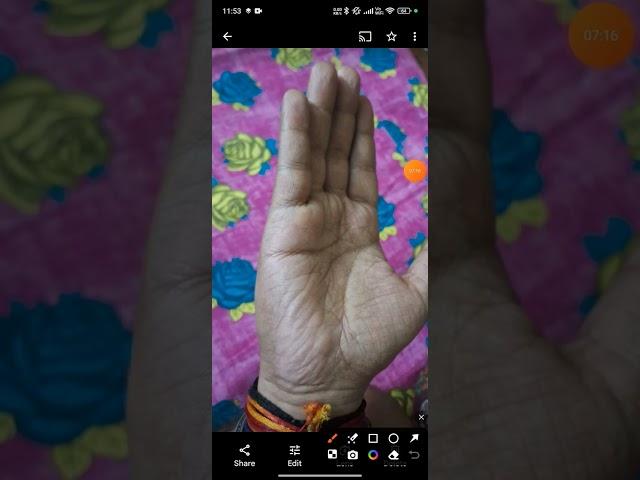 stress and health problems sign on palm #palmistry #palmist Bhardwaj