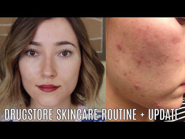Accutane Round Two + Drugstore Skincare Routine