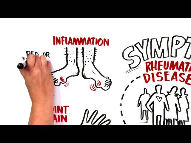 When Should I see a Rheumatologist?