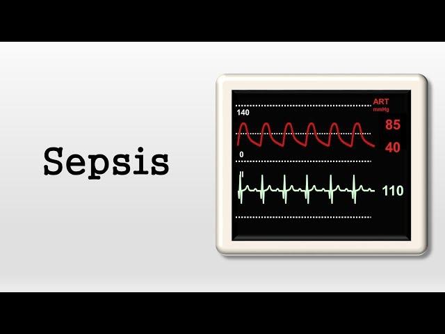 Sepsis and Septic Shock