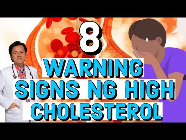 8 Warning Signs ng High Cholesterol - Tips by Doc Willie Ong (Internist and Cardiologist)