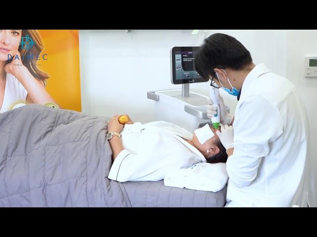 Trẻ Hóa, Xóa Nhăn Mắt Với Dr. Long Tại Viện Thẩm Mỹ Công Nghệ Cao Daimec - Công Nghệ Thermage Flx