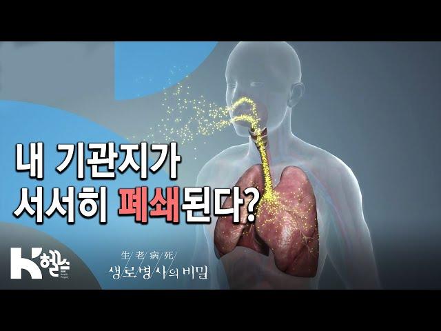 폐의 구조와 기능- 717회(19.12.04) 몰라서 더 무섭다, COPD(만성폐쇄성폐질환)