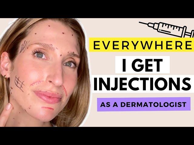 Exactly Where I Get Injections and Why | Best Botox and Filler Placement | Dr. Sam Ellis