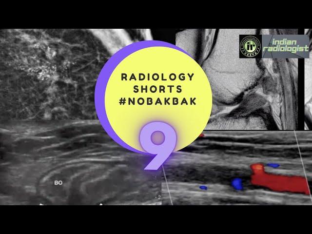 WHAT IS THE FINDING | WHAT SURGERY HAS BEEN PERFORMED IN THE PAST | NOBAKBAK RADIOLOGY SHORTS