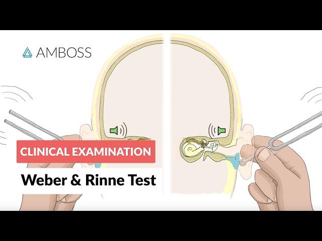 Weber and Rinne Test - Clinical Examination