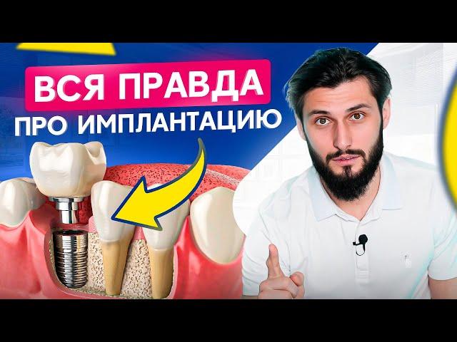 Посмотри это видео перед тем, как ставить ИМПЛАНТЫ. Стоматологи умалчивают об этом