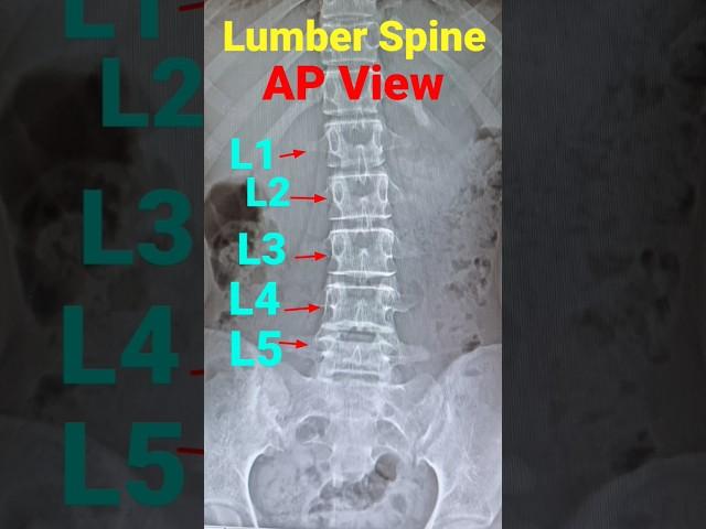 Lumber Spine|Lumber Vertebra|L-Spine#short #radiology #xray