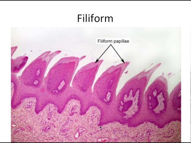 Histology- Taste Buds and Lingual Papillae