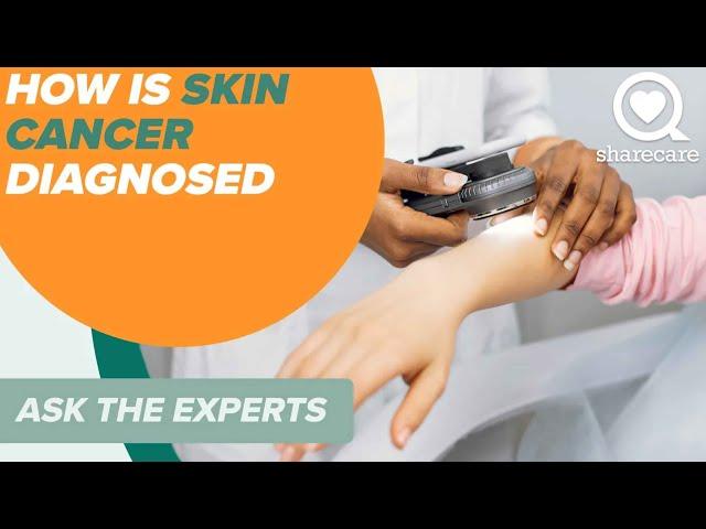 How Is Skin Cancer Diagnosed? | Ask The Experts | Sharecare