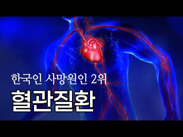 당신의 혈관은 깨끗하신가요? | 건강플러스 | 04월 08일