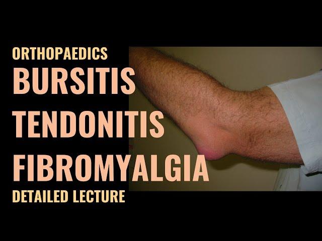 Bursitis, Tendonitis and Fibromyalgia - Detailed explanation - Emergency Medicine