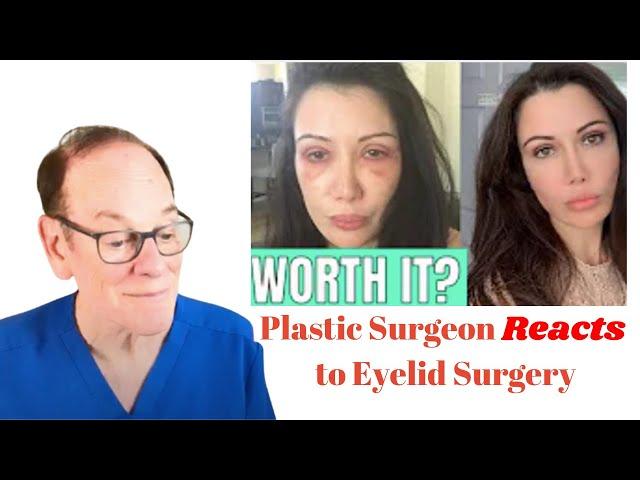 Plastic Surgeon Reacts | Lorry Hill's Blepharoplasty Before & After